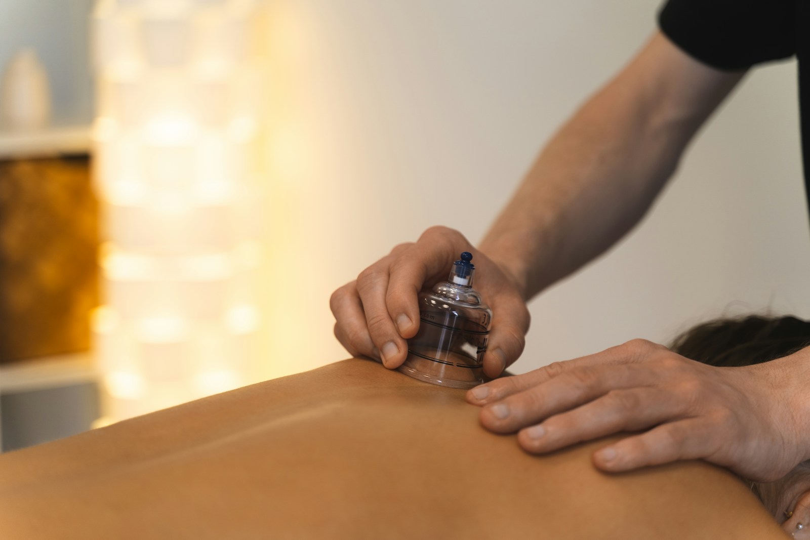Cupping therapy